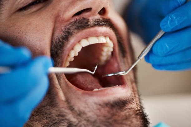 Best Broken or Cracked Tooth Emergency Dentist in Martins Ferry, OH