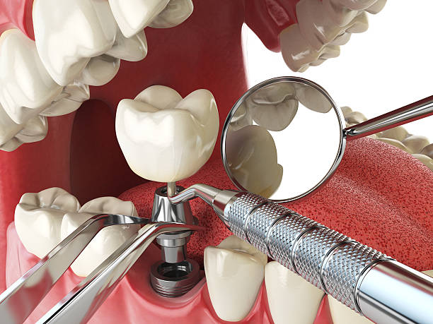 Best Emergency Dental Services for Seniors in Martins Ferry, OH